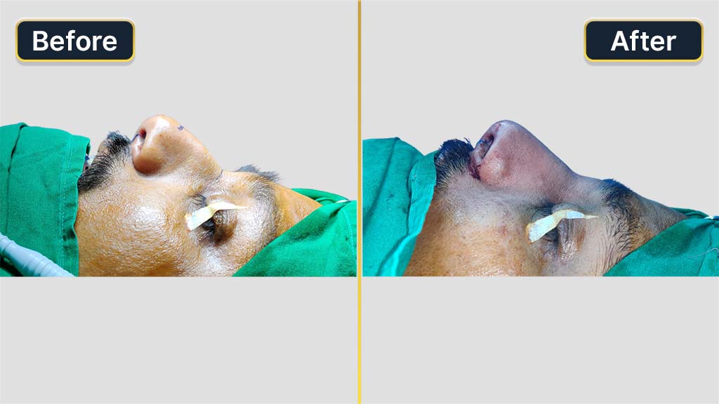 Before and After Transformation