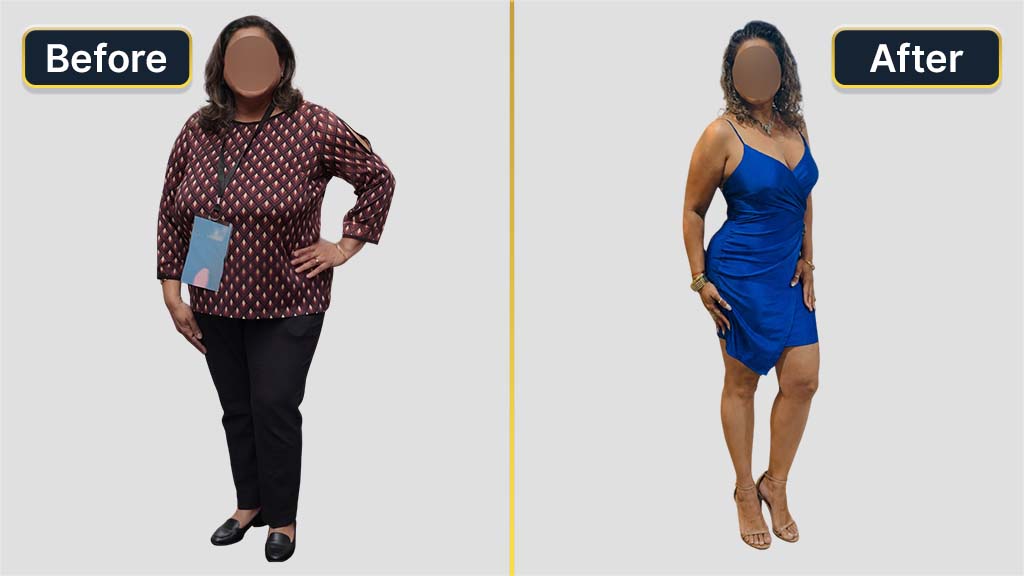 Mommy Makeover Before and After