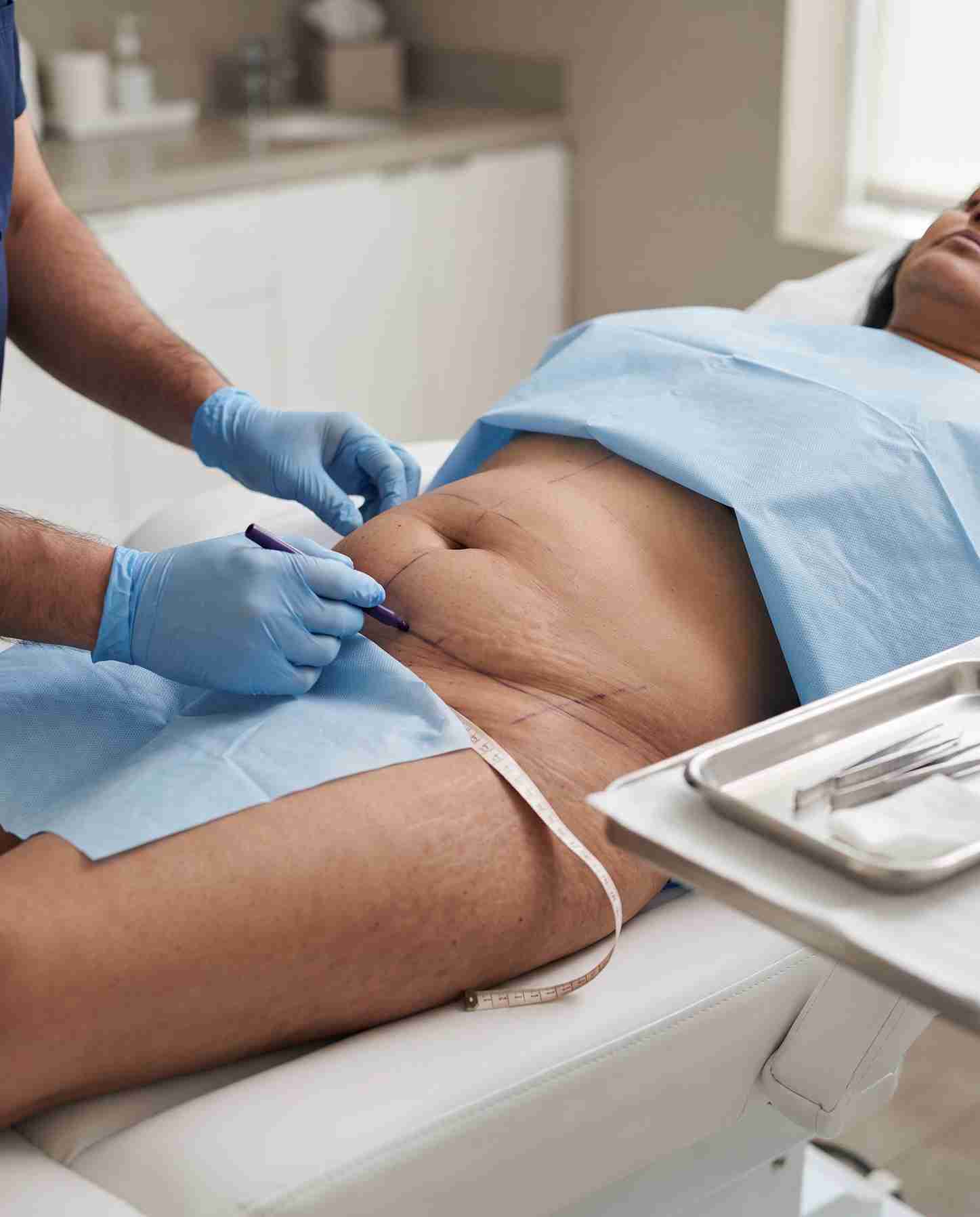 Body Surgeries