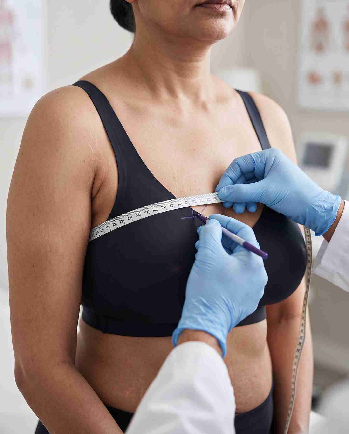 Breast Surgeries