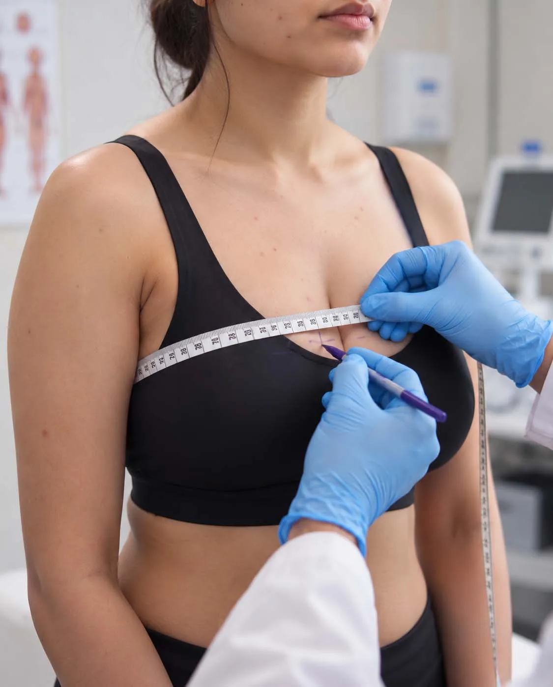 Breast Surgeries